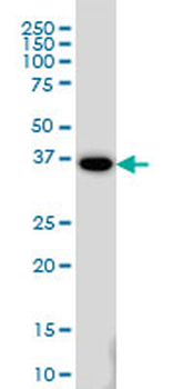 MEOX2 monoclonal antibody (M03), clone 6A5