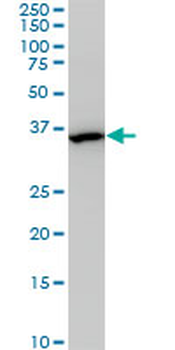 MEOX2 monoclonal antibody (M03), clone 6A5