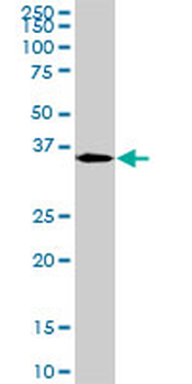 MEOX2 monoclonal antibody (M03), clone 6A5