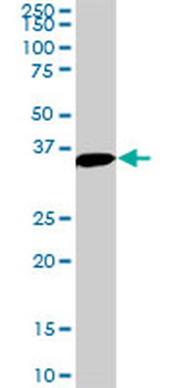 MEOX2 monoclonal antibody (M03), clone 6A5