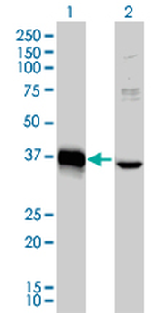 MEOX2 monoclonal antibody (M03), clone 6A5