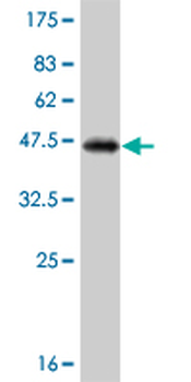 SMAD3 monoclonal antibody (M02), clone 7F3