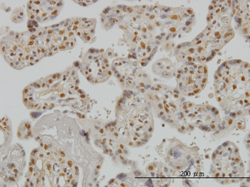 SMAD3 monoclonal antibody (M02), clone 7F3