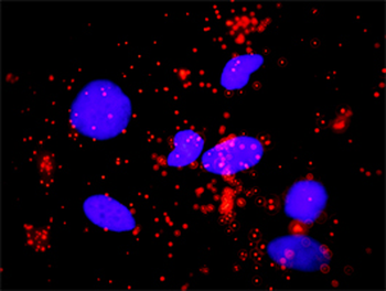 SMAD3 monoclonal antibody (M02), clone 7F3