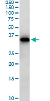 SMAD3 monoclonal antibody (M02), clone 7F3