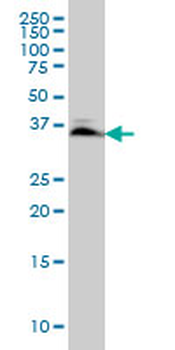 SMAD3 monoclonal antibody (M02), clone 7F3