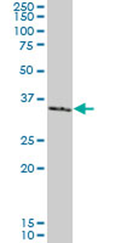 SMAD3 monoclonal antibody (M02), clone 7F3