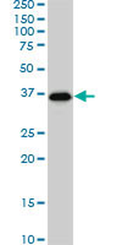 SMAD3 monoclonal antibody (M02), clone 7F3