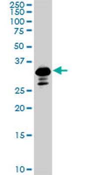 SMAD3 monoclonal antibody (M02), clone 7F3