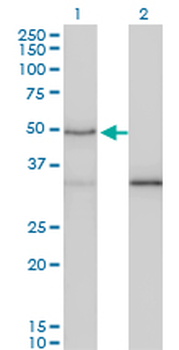 SMAD3 monoclonal antibody (M02), clone 7F3