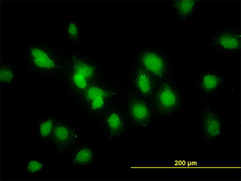 SMAD1 monoclonal antibody (M03), clone 2E9