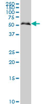 SMAD1 monoclonal antibody (M03), clone 2E9