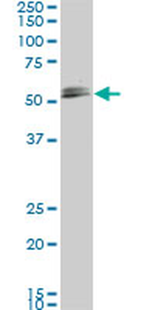 SMAD1 monoclonal antibody (M03), clone 2E9