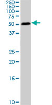 SMAD1 monoclonal antibody (M03), clone 2E9