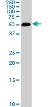 SMAD1 monoclonal antibody (M03), clone 2E9