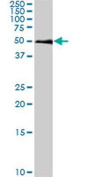 SMAD1 monoclonal antibody (M03), clone 2E9