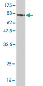 SMAD1 monoclonal antibody (M03), clone 2E9