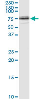 LMNB1 monoclonal antibody (M01), clone 4B10