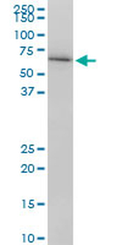 LMNB1 monoclonal antibody (M01), clone 4B10