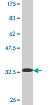 LMNB1 monoclonal antibody (M01), clone 4B10