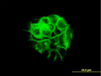 JUP monoclonal antibody (M01), clone 2G9