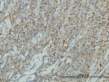 JUP monoclonal antibody (M01), clone 2G9