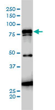 JUP monoclonal antibody (M01), clone 2G9