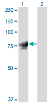 JUP monoclonal antibody (M01), clone 2G9