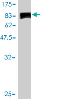 JUP monoclonal antibody (M01), clone 2G9