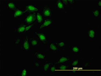 ID3 monoclonal antibody (M02), clone 3E10