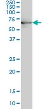 HSPA1B monoclonal antibody (M02), clone 3B7