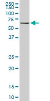 HSPA1B monoclonal antibody (M02), clone 3B7