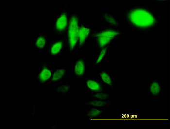 HSPA1B monoclonal antibody (M02), clone 3B7