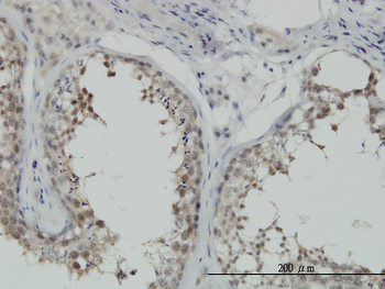 HSPA1B monoclonal antibody (M02), clone 3B7