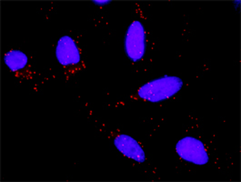 HSPA1B monoclonal antibody (M02), clone 3B7