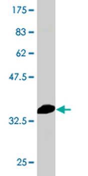 HSPA1B monoclonal antibody (M02), clone 3B7