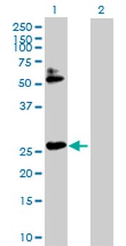 HOXB7 purified MaxPab rabbit polyclonal antibody (D01P)