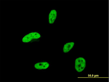 HOXA9 monoclonal antibody (M01), clone 2A11-2D2