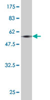 HOXA9 monoclonal antibody (M01), clone 2A11-2D2