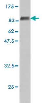 HDAC1 monoclonal antibody (M14), clone 5C11