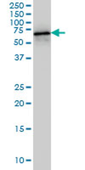 HDAC1 monoclonal antibody (M14), clone 5C11