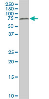 HDAC1 monoclonal antibody (M14), clone 5C11