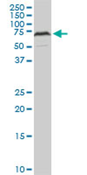 HDAC1 monoclonal antibody (M14), clone 5C11