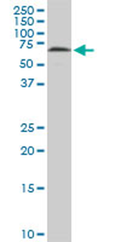 HDAC1 monoclonal antibody (M14), clone 5C11