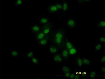 HDAC1 monoclonal antibody (M14), clone 5C11