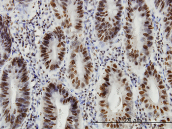 HDAC1 monoclonal antibody (M14), clone 5C11