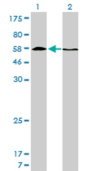 HDAC1 monoclonal antibody (M14), clone 5C11