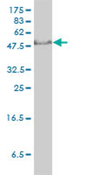 GTF2H1 monoclonal antibody (M01), clone 1F12-1B5