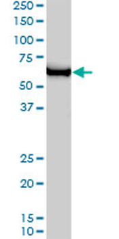 GTF2H1 monoclonal antibody (M01), clone 1F12-1B5