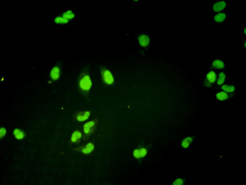 GTF2H1 monoclonal antibody (M01), clone 1F12-1B5